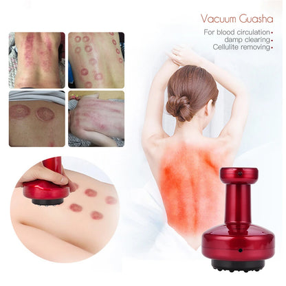 CkeyIN Electric Body Shaping Massager | Heat Cupping Gua Sha Scrapping Massage - Rechargeable